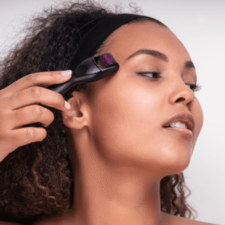 Girl using a Derma roller