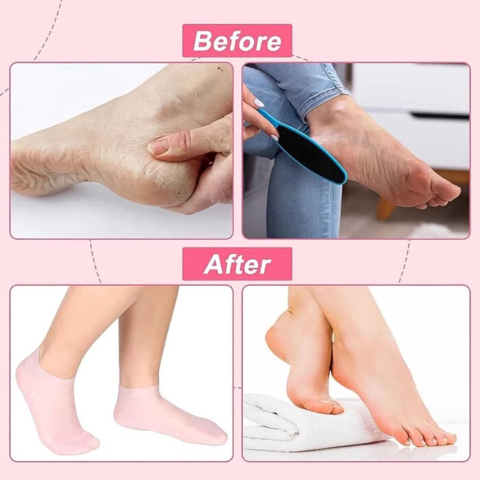 Silicone Moisturizing Socks 3