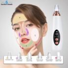 6-In-1-Derma-Suction-blackhead4-1749897870