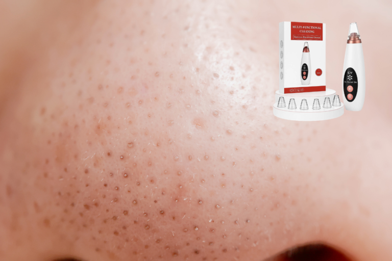 Blackhead Remover Machine Side Effects: What You Must Know Before Using One